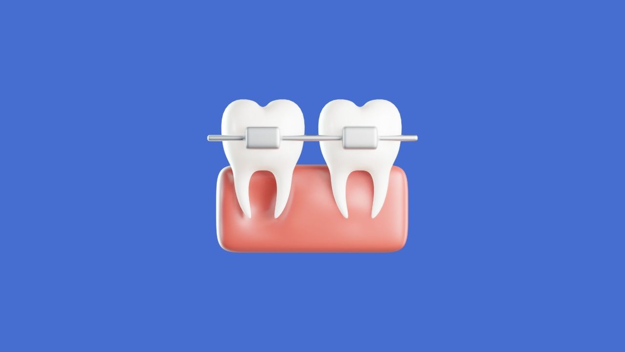 Diş Hekimliğinde 3D Ağız İçi Tarayıcıları