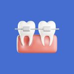 Diş Hekimliğinde 3D Ağız İçi Tarayıcıları